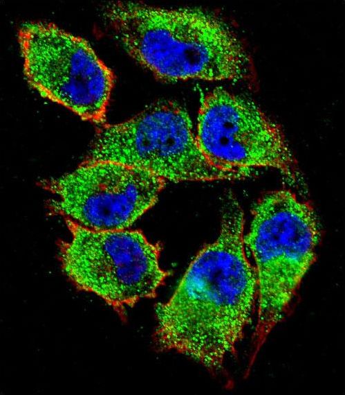 Confocal immunofluorescent of NKD2 Antibody with A375 cell followed by Alexa Fluor 488-conjugated goat anti-rabbit lgG (green). Actin filaments have been labeled with Alexa Fluor 555 phalloidin (red). DAPI was used to stain the cell nuclear (blue).