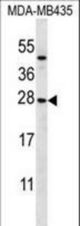 KLRC1 Antibody western blot of MDA-MB435 cell line lysates (35 ug/lane). The KLRC1 antibody detected the KLRC1 protein (arrow).