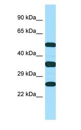 NKG2DL4 / ULBP4 antibody Western Blot of MCF7.