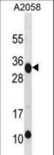 RAET1E Antibody western blot of A2058 cell line lysates (35 ug/lane). The RAET1E antibody detected the RAET1E protein (arrow).