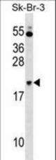 NKIRAS1 Antibody western blot of SK-BR-3 cell line lysates (35 ug/lane). The NKIRAS1 antibody detected the NKIRAS1 protein (arrow).