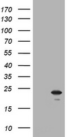 HEK293T cells were transfected with the pCMV6-ENTRY control (Left lane) or pCMV6-ENTRY NKIRAS1 (Right lane) cDNA for 48 hrs and lysed. Equivalent amounts of cell lysates (5 ug per lane) were separated by SDS-PAGE and immunoblotted with anti-NKIRAS1.