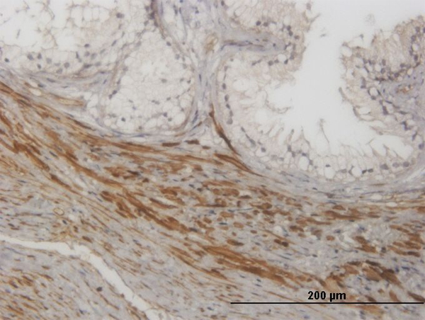 Immunoperoxidase of monoclonal antibody to NKIRAS1 on formalin-fixed paraffin-embedded human prostate. [antibody concentration 1 ug/ml]