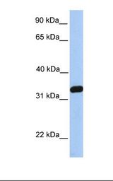 721_B cell lysate. Antibody concentration: 1.0 ug/ml. Gel concentration: 12%.
