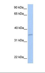 721_B cell lysate. Antibody concentration: 1.0 ug/ml. Gel concentration: 12%.