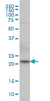 NKIRAS2 monoclonal antibody (M02), clone 2G9 Western blot of NKIRAS2 expression in HeLa.