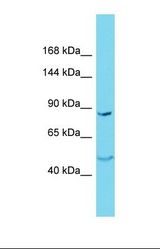 Western blot of Jurkat. NSMCE4A antibody dilution 1.0 ug/ml.