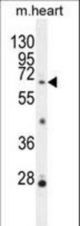 NKPD1 Antibody western blot of mouse heart tissue lysates (35 ug/lane). The NKPD1 antibody detected the NKPD1 protein (arrow).
