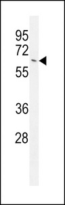 NKPD1 Antibody western blot of MCF-7 cell line lysates (35 ug/lane). The NKPD1 antibody detected the NKPD1 protein (arrow).