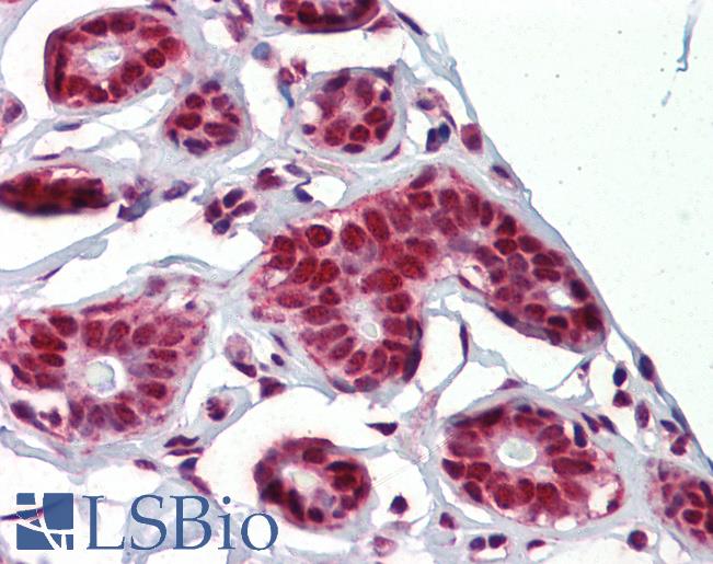Anti-NKRF antibody IHC of human breast. Immunohistochemistry of formalin-fixed, paraffin-embedded tissue after heat-induced antigen retrieval. Antibody LS-B3529 concentration 5 ug/ml.