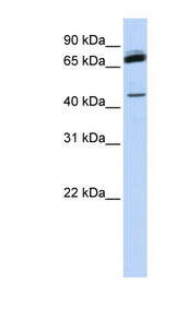 NKRF antibody LS-B3529 Western blot of Fetal Muscle lysate.