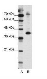 A: Marker, B: HepG2 Cell Lysate