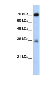 NKRF antibody LS-C110098 Western blot of Transfected 293T cell lysate.
