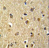 Formalin-fixed and paraffin-embedded human brain reacted with NKRF Antibody , which was peroxidase-conjugated to the secondary antibody, followed by DAB staining. This data demonstrates the use of this antibody for immunohistochemistry; clinical relevance has not been evaluated.