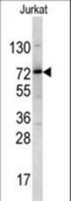 Western blot of NKRF antibody in Jurkat cell line lysates (35 ug/lane). NKRF (arrow) was detected using the purified antibody.