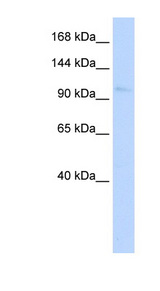 NKX1-1 antibody LS-C111155 Western blot of Fetal Lung lysate.
