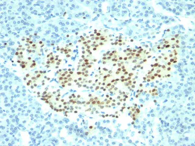 Immunohistochemistry of formalin-fixed, paraffin-embedded human pancreas stained with NKX2.2 NX2/294 antibody (1:100), peroxidase-conjugate and DAB chromogen.