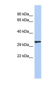 NKX2-2 antibody LS-C109653 Western blot of Fetal Spleen lysate.