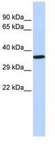 Western blot of placenta lysate.