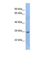 Western blot of Human Jurkat. NKX2-2 antibody dilution 1.0 ug/ml.