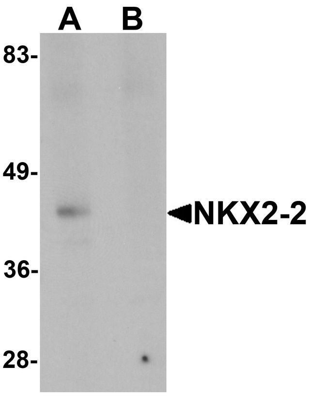 Western blot analysis of NKX2-2 in rat kidney tissue lysate with NKX2-2 antibody at 1 ug/ml in (A) the absence and (B) the presence of blocking peptide.