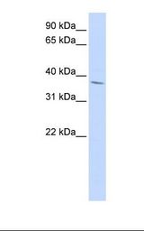 HepG2 cell lysate. Antibody concentration: 1.0 ug/ml. Gel concentration: 12%.
