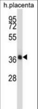NKX2-4 Antibody western blot of human placenta tissue lysates (35 ug/lane). The NKX2-4 antibody detected the NKX2-4 protein (arrow).
