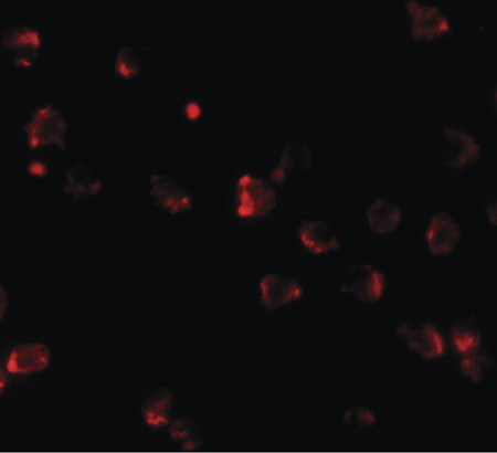 Immunofluorescence of NKX2-4 in A20 cells with NKX2-4 antibody at 20 ug/ml.