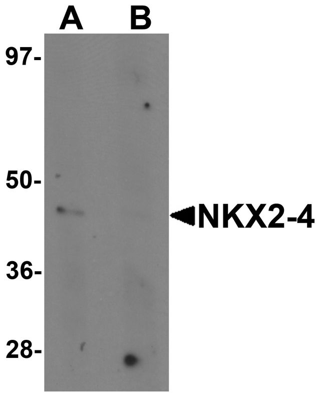 Western blot analysis of NKX2-4 in A20 cell lysate with NKX2-4 antibody at 1 ug/ml in (A) the absence and (B) the presence of blocking peptide.