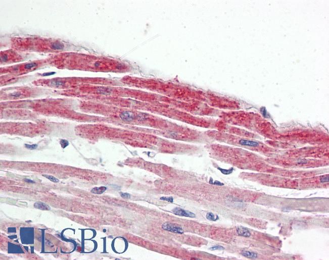 Anti-NKX2-5 antibody IHC staining of human heart. Immunohistochemistry of formalin-fixed, paraffin-embedded tissue after heat-induced antigen retrieval.