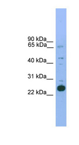 NKX2-6 antibody LS-C116053 Western blot of Mouse Heart lysate.