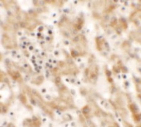 Immunohistochemistry of NKX2-8 in human liver tissue with NKX2-8 antibody at 2.5 ug/ml.