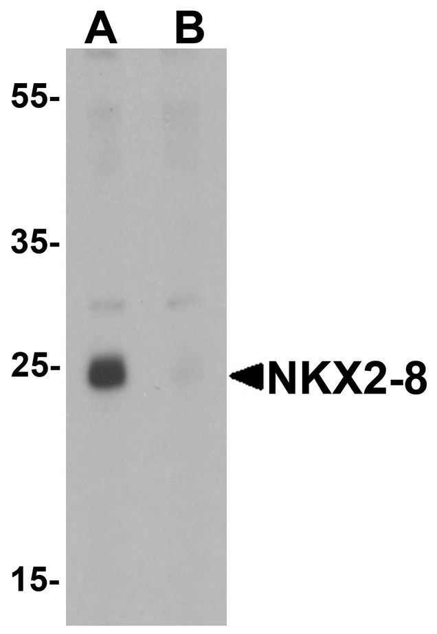 Western blot analysis of NKX2-8 in rat liver tissue lysate with NKX2-8 antibody at 1 ug/ml in (A) the absence and (B) the presence of blocking peptide