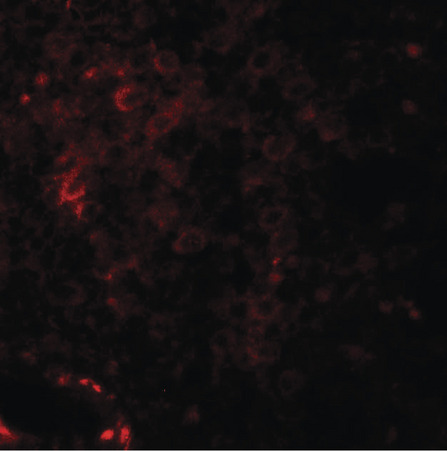 Immunofluorescence of NKX-6 in human spleen tissue with NKX2-6 antibody at 20 ug/ml.
