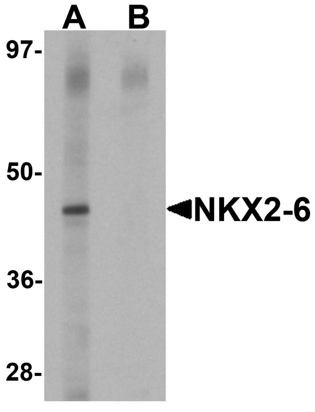 Western blot analysis of NKX2-6 in mouse heart tissue lysate with NKX2-6 antibody at 1 ug/ml in (A) the absence and (B) the presence of blocking peptide.