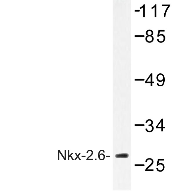 Western blot of Nkx-2.6 (R133) pAb in extracts from COLO cells.