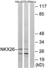 Western blot of extracts from HeLa/COLO cells, using NKX26 Antibody. The lane on the right is treated with the synthesized peptide.