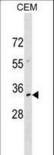 NKX2-6 Antibody western blot of CEM cell line lysates (35 ug/lane). The NKX2-6 antibody detected the NKX2-6 protein (arrow).