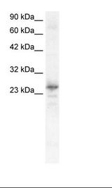 Fetal Heart Lysate