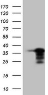HEK293T cells were transfected with the pCMV6-ENTRY control (Left lane) or pCMV6-ENTRY NKX3-1 (Right lane) cDNA for 48 hrs and lysed. Equivalent amounts of cell lysates (5 ug per lane) were separated by SDS-PAGE and immunoblotted with anti-NKX3-1.