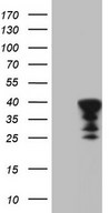 HEK293T cells were transfected with the pCMV6-ENTRY control (Left lane) or pCMV6-ENTRY NKX3-1 (Right lane) cDNA for 48 hrs and lysed. Equivalent amounts of cell lysates (5 ug per lane) were separated by SDS-PAGE and immunoblotted with anti-NKX3-1.