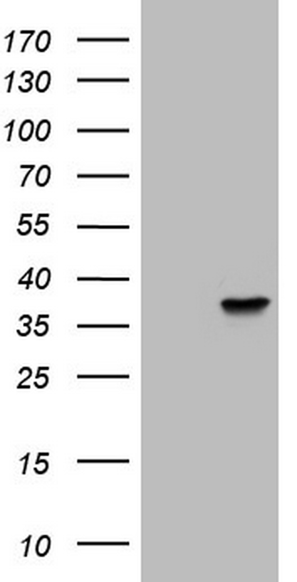 HEK293T cells were transfected with the pCMV6-ENTRY control (Left lane) or pCMV6-ENTRY NKX3-1 (Right lane) cDNA for 48 hrs and lysed. Equivalent amounts of cell lysates (5 ug per lane) were separated by SDS-PAGE and immunoblotted with anti-NKX3-1.