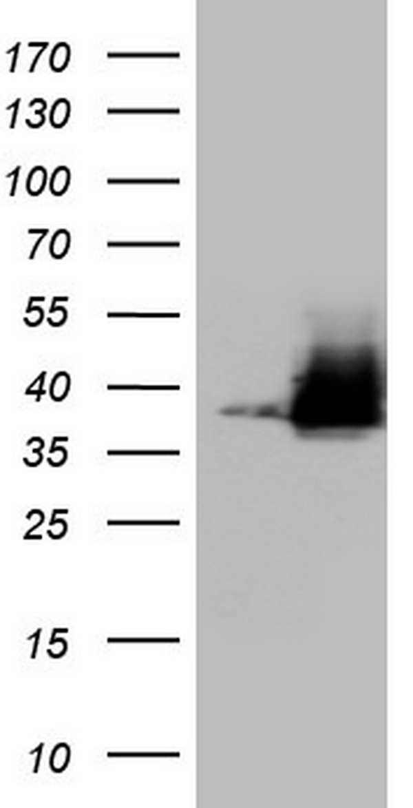 HEK293T cells were transfected with the pCMV6-ENTRY control (Left lane) or pCMV6-ENTRY NKX3-1 (Right lane) cDNA for 48 hrs and lysed. Equivalent amounts of cell lysates (5 ug per lane) were separated by SDS-PAGE and immunoblotted with anti-NKX3-1.