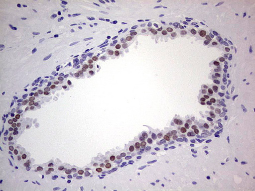 IHC of paraffin-embedded Human prostate tissue using anti-NKX3-1 mouse monoclonal antibody. (Heat-induced epitope retrieval by 1 mM EDTA in 10mM Tris, pH8.5, 120°C for 3min).