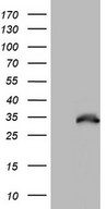 HEK293T cells were transfected with the pCMV6-ENTRY control (Left lane) or pCMV6-ENTRY NKX3-1 (Right lane) cDNA for 48 hrs and lysed. Equivalent amounts of cell lysates (5 ug per lane) were separated by SDS-PAGE and immunoblotted with anti-NKX3-1.