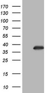 HEK293T cells were transfected with the pCMV6-ENTRY control (Left lane) or pCMV6-ENTRY NKX3-1 (Right lane) cDNA for 48 hrs and lysed. Equivalent amounts of cell lysates (5 ug per lane) were separated by SDS-PAGE and immunoblotted with anti-NKX3-1.