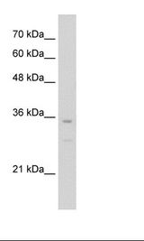 Jurkat Cell Lysate