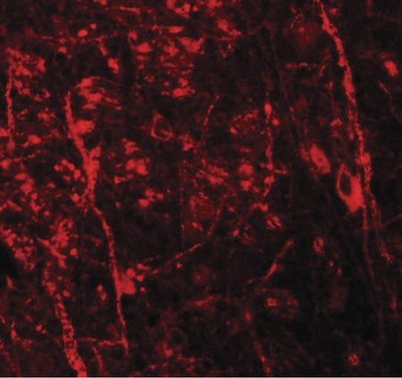 Immunofluorescence of BAPX1 in mouse brain tissue with BAPX1 antibody at 20 ug/ml.