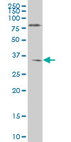NKX6-1 monoclonal antibody (M01), clone 1B7 Western Blot analysis of NKX6-1 expression in HL-60.
