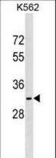 NKX6-2 Antibody western blot of K562 cell line lysates (35 ug/lane). The NKX6-2 antibody detected the NKX6-2 protein (arrow).
